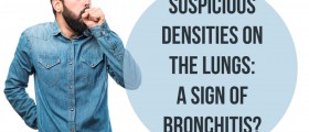 Suspicious Densities On The Lungs: A Sign Of Bronchitis?