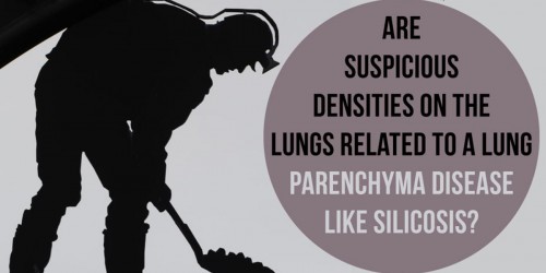 Suspicious Densities On The Lungs: Related To A Lung Parenchyma Disease Like Silicosis?