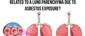 Suspicious Densities On The Lungs: Related To A Lung Parenchyma Due To Asbestos Exposure?