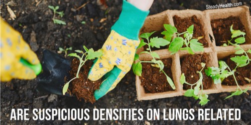Suspicious Densities On The Lungs: Related To The Fungal Infection Blastomycosis?
