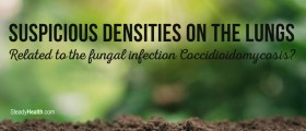 Suspicious Densities On The Lungs: Related To The Fungal Infection Coccidioidomycosis?
