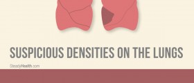 Suspicious Densities On The Lungs: Related To The Fungal Infection Histoplasmosis?