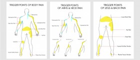 Symptoms And Treatment: The Difference Between Fibromyalgia And Myofascial Pain Syndrome