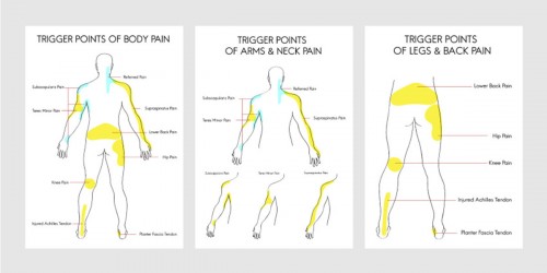 Symptoms And Treatment: The Difference Between Fibromyalgia And Myofascial Pain Syndrome