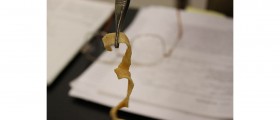 Intestinal Infections with Tapeworm Parasites