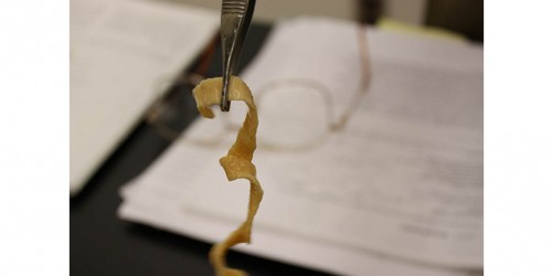 Intestinal Infections with Tapeworm Parasites