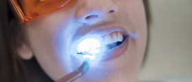 Teeth Whitening: Is it a scam?