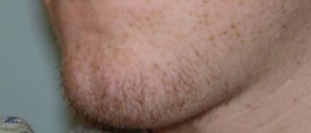 Puberty & my first body hair