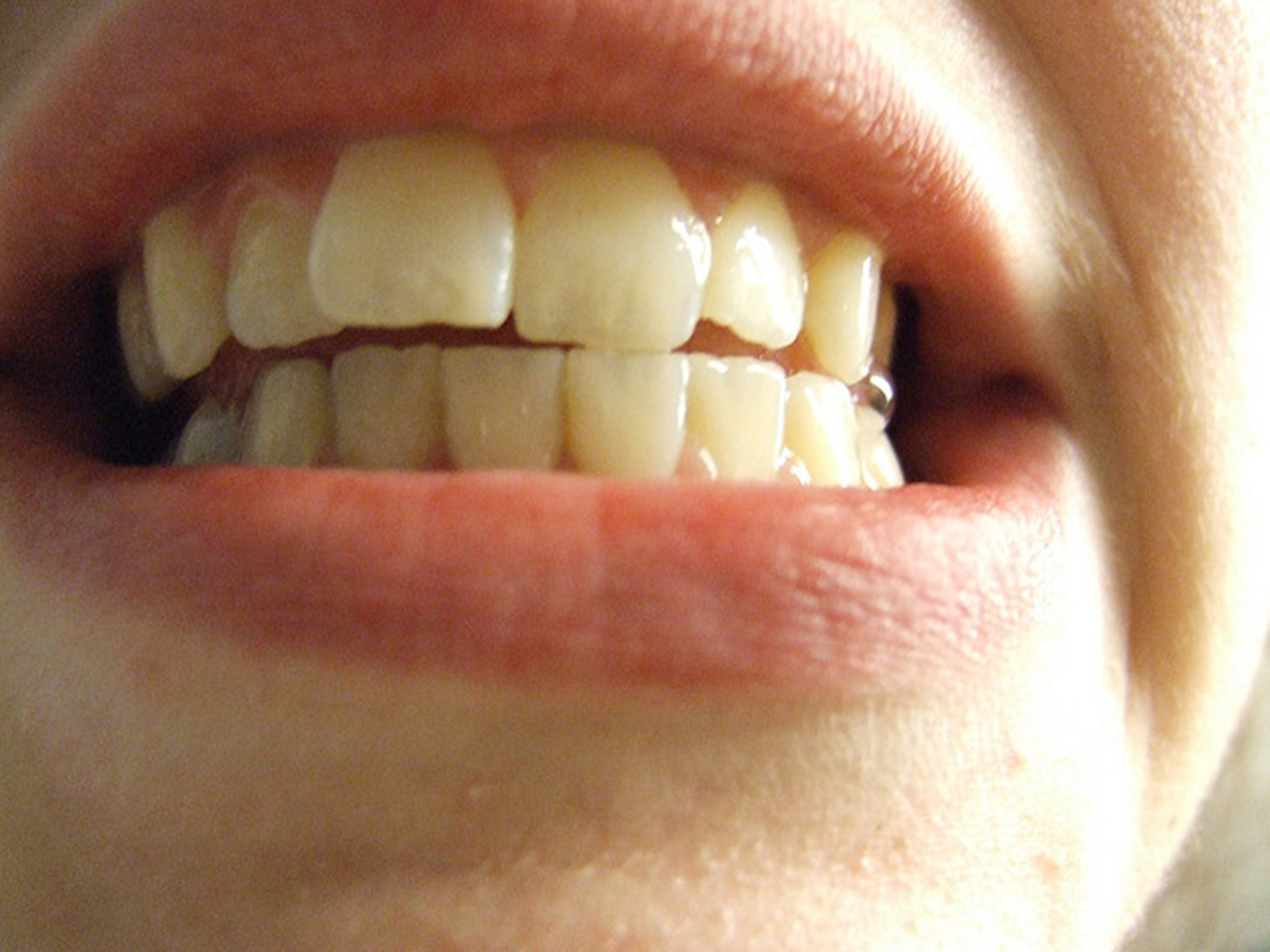 Lab-Grown Teeth: Dentistry's Final Frontier? | Ear, Nose, Throat, and