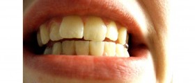 New Scientific Statement: Link Between Gum Disease And Heart Attack Does Not Exist