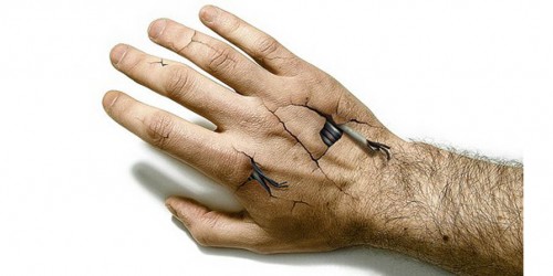 Tackling Your Tendinitis During Your Workout