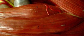 Free Your Arm: How Your Teres Major Is Tying You Down