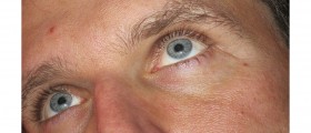 Does Testosterone Replacement Work?