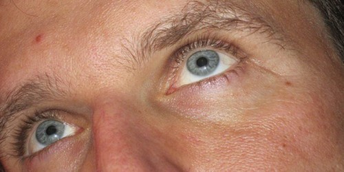 Does Testosterone Replacement Work?