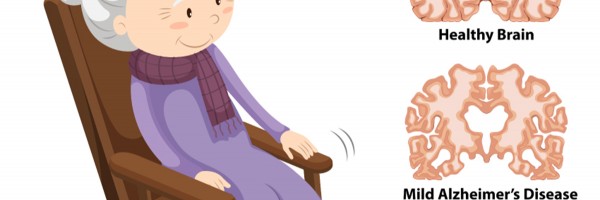 The 3 Stages of Alzheimer’s Disease: How Does the Disease Progress and Can You Stop It?