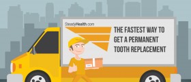 The Fastest Way To Get A Permanent Tooth Replacement