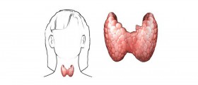 Hypothyroidism and the weight battle