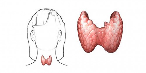 Hypothyroidism and the weight battle