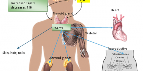 Holistic Approach to Thyroid Related Problems: Naturopathic Medicine for Thyroid Disease