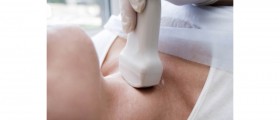 Alternative Treatments for Thyroid Cancer