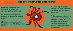Do You Have A Beef With The Lone Star Tick? Tick Bite Causes Meat Allergy