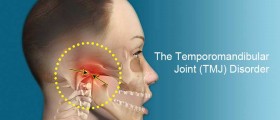 Temporomandibular Joint Syndrome