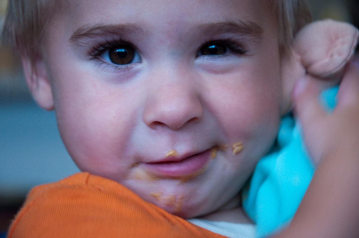 Early Exposure Of Infants To Potential Allergens Prevents Development ...