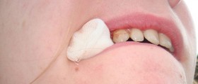 Tooth extraction: Would You Be Able To Recognize Infection And Other Complications?