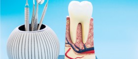 Tooth Fracture After Root Canal Treatment