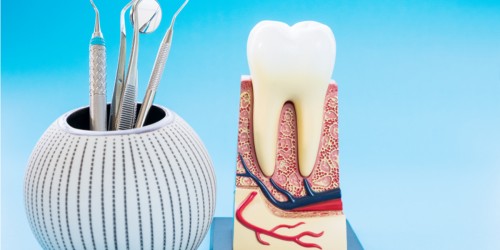 Tooth Fracture After Root Canal Treatment