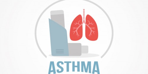 Types Of Asthma: How Is Asthma Classified?