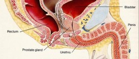 Urine odor: Is smelly urine a symptom of Urinary Tract Infection (UTI)?