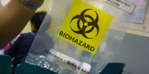 Mucus In Urine And Other Urinary Tract Symptoms: When You Need To Go To The Doctor