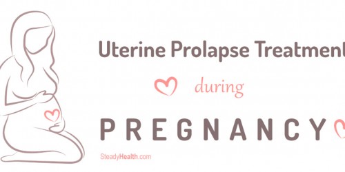 Uterine Prolapse Treatment During Pregnancy