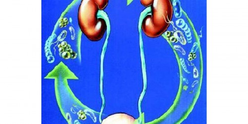 Recurring Urinary Tract Infection