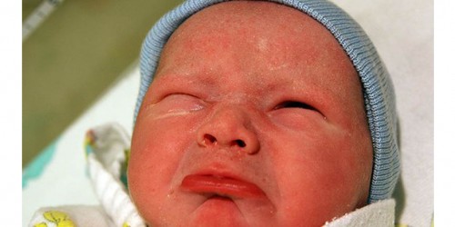 Vaginal Breech Delivery: Is It Safe?