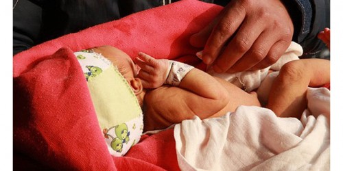 Male Varicocele And Infertility: Myths And Reality