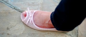 Varicose Veins: Should You Consider Laser Surgery?