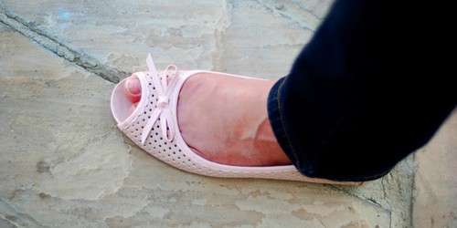 Varicose Veins: Should You Consider Laser Surgery?