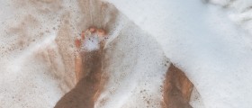 Vibriosis: How To Protect Yourself From A Potentially Fatal Flesh-Eating Bacteria Infection While At The Beach Or In The Sea