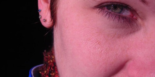 Vitamin D Could Help Heart-Failure Patients, Study Suggests