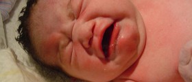 CDC Warns Against Declining Vitamin K Shot At Birth