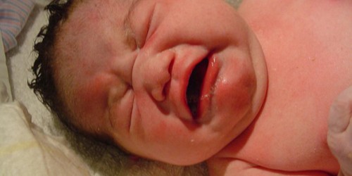 CDC Warns Against Declining Vitamin K Shot At Birth