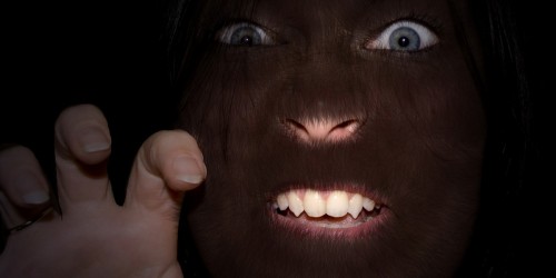 Hypertrichosis: The Hair You Wish You Never Had