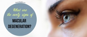 What are the Early Signs of Macular Degeneration?