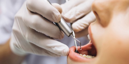 What Are The Possible Complications After A Root Canal Treatment?
