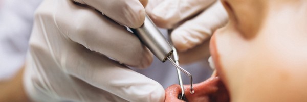 What Are The Possible Complications After A Root Canal Treatment?