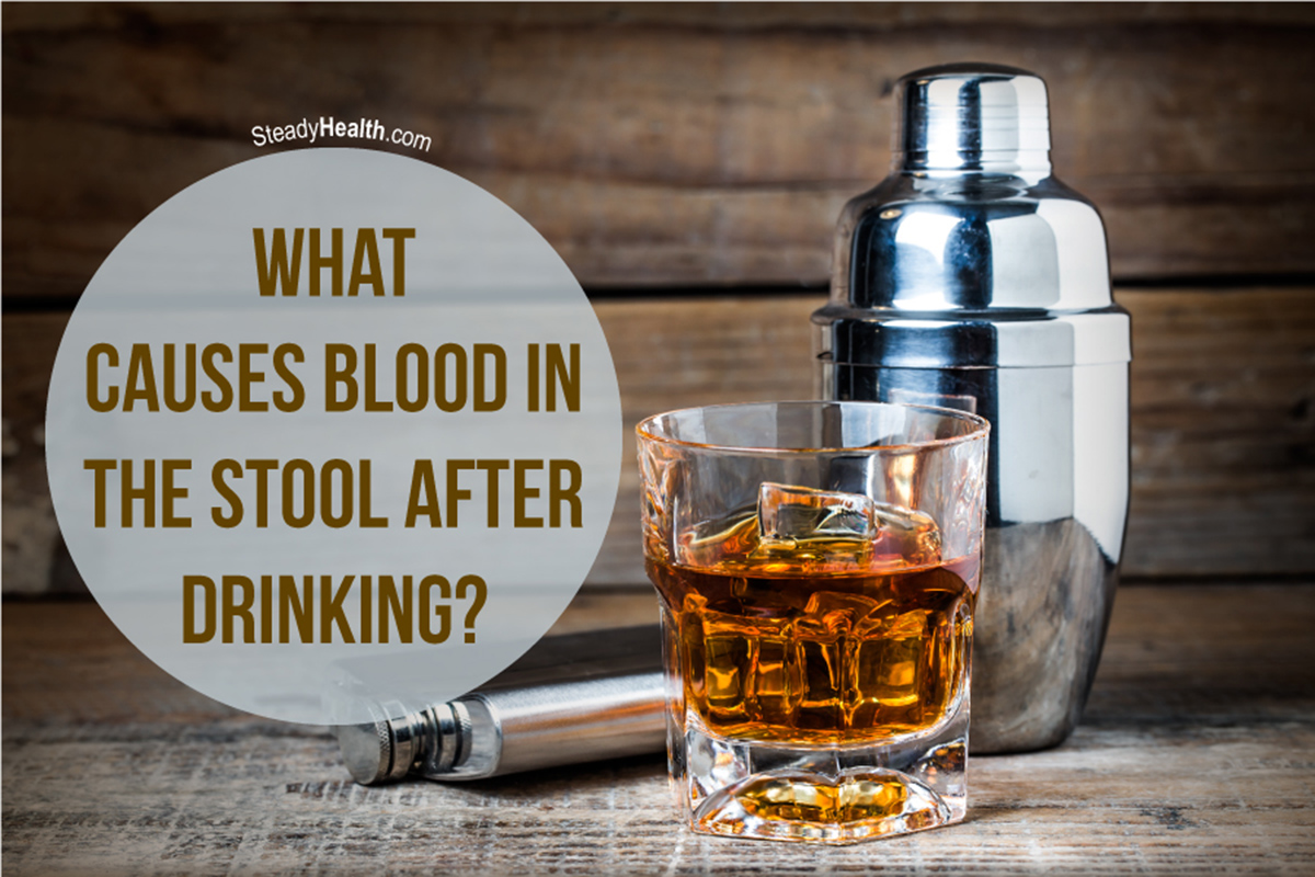 bloody stool alcohol
