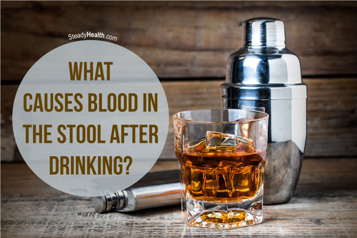 What Causes Blood In The Stool After Drinking ...