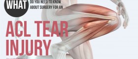 What Do You Need To Know About Surgery For An ACL Tear Injury?